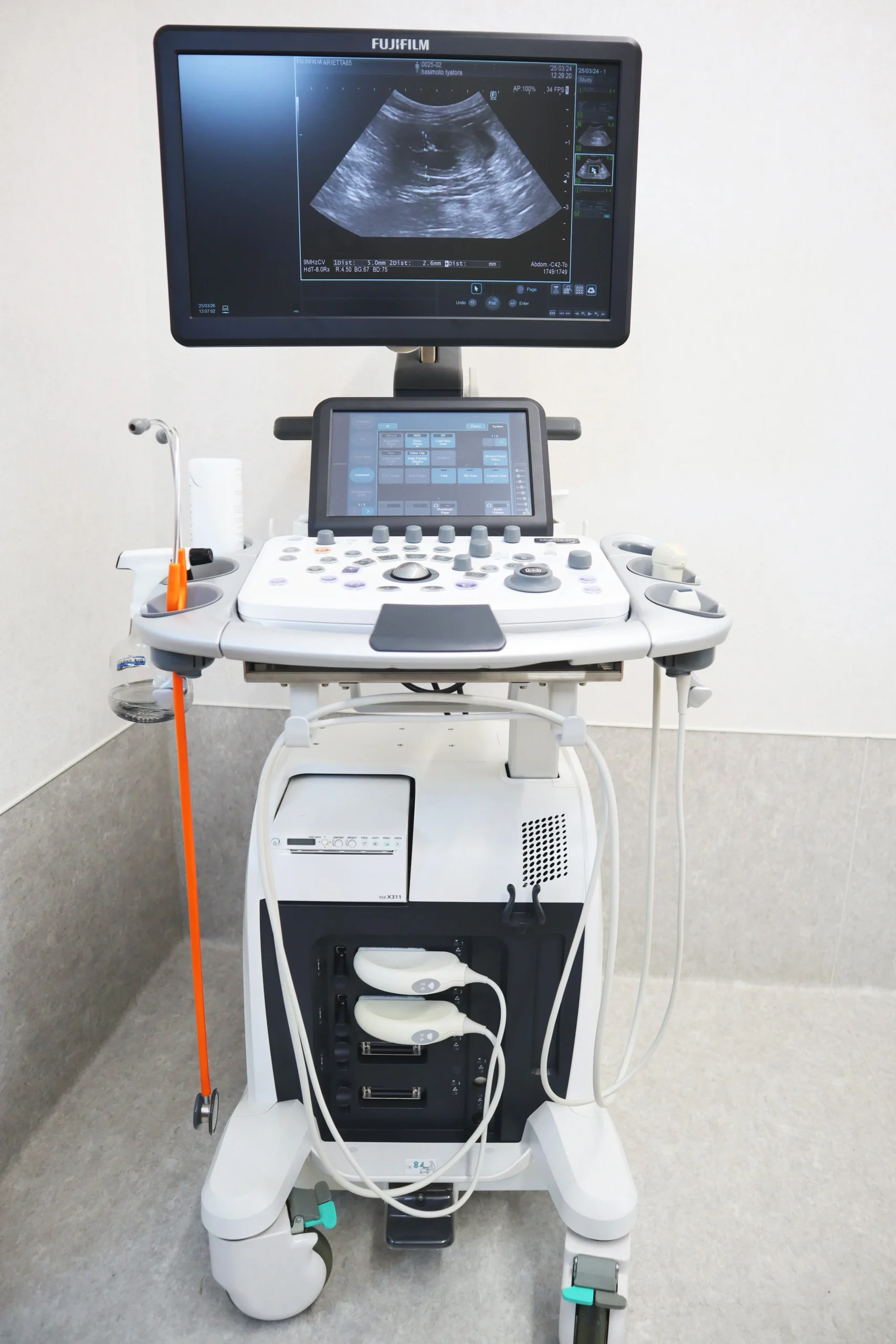 エコー検査機器